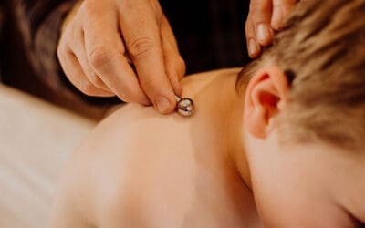 Acupuncture for Kids Colorado Springs